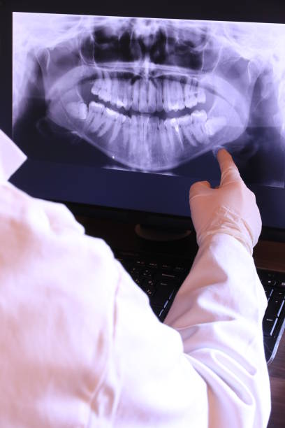 Best Emergency Dentist for Lost Fillings or Crowns in Paducah, TX
