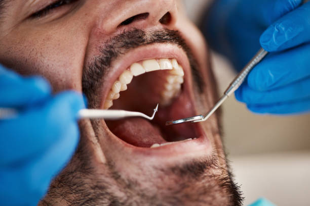 Best Emergency Dental Services for Seniors in Paducah, TX