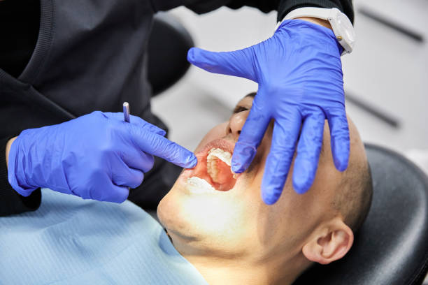 Best Emergency Dental Extractions in Paducah, TX